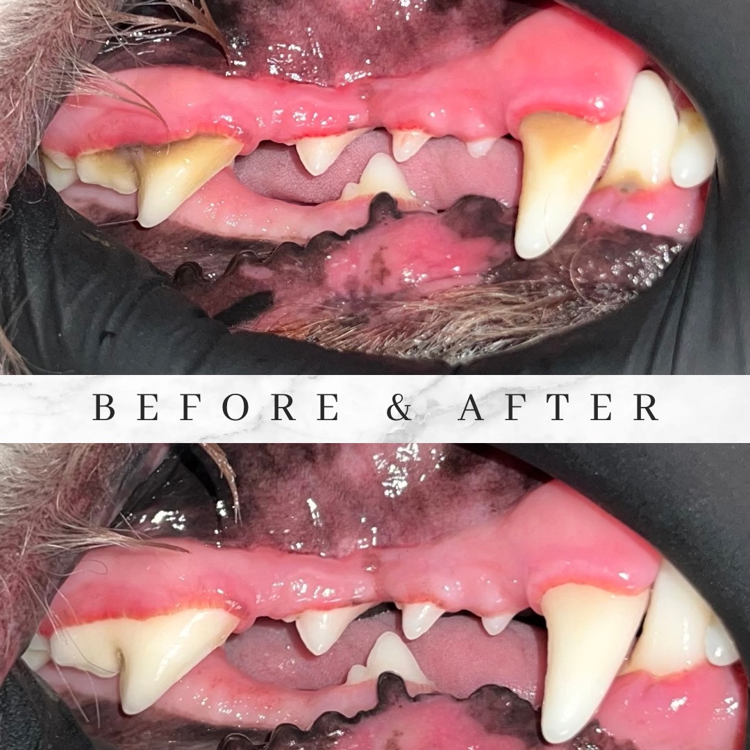 Before and after gentle in-home teeth cleaning results