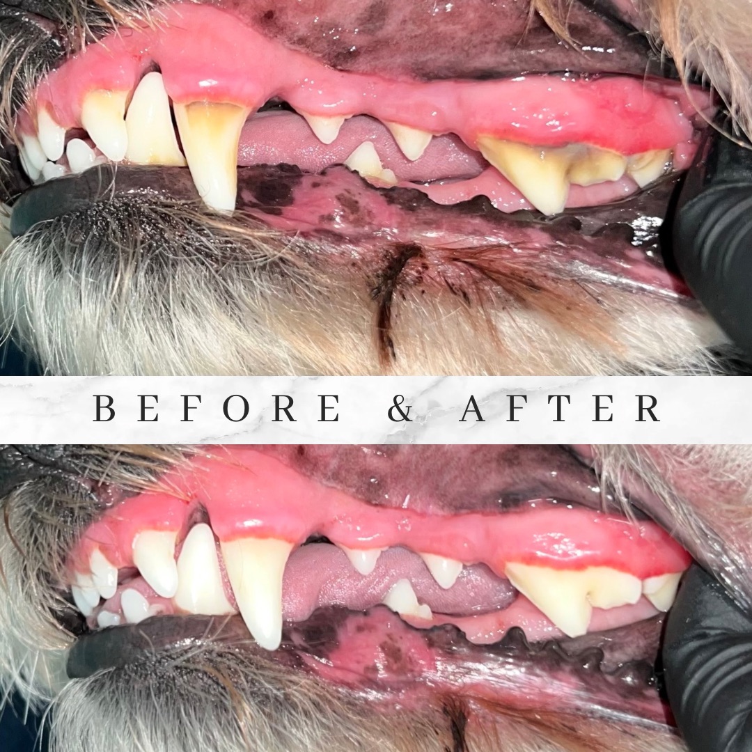 Before and after gentle in-home teeth cleaning results