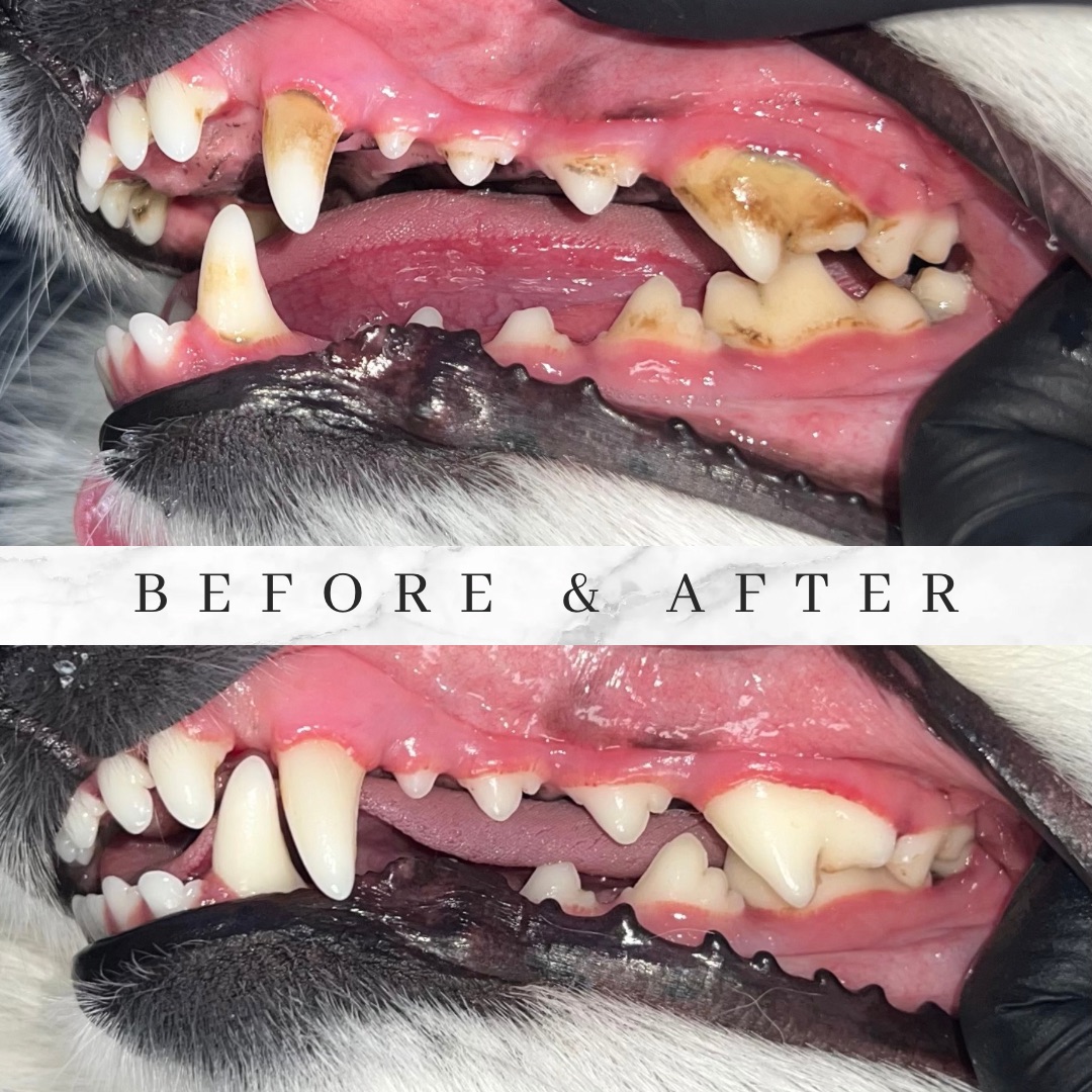 Before and after gentle in-home teeth cleaning results